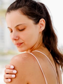 Verbrand door de zon: Wat te doen? Tips voor verzorging