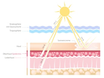 Protezione solare al mare – Un ombrellone per creare ombra