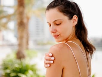 Wat helpt tegen een verbrande huid – Huismiddeltjes of crème met aloë vera verlagen de pijn.